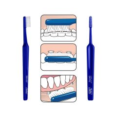 Tepe Özel Diş Fırçası Implant Orthodontic