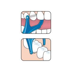 Tepe Diş İpi Çatal Mini Flosser 36 lı