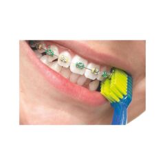 Curaprox Ortodontik Diş Fırçası CS 5460 Ortho
