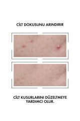 Vichy Normaderm Probio BHA Peeling Etkili Cilt Kusuru Karşıtı Serum 30 ml